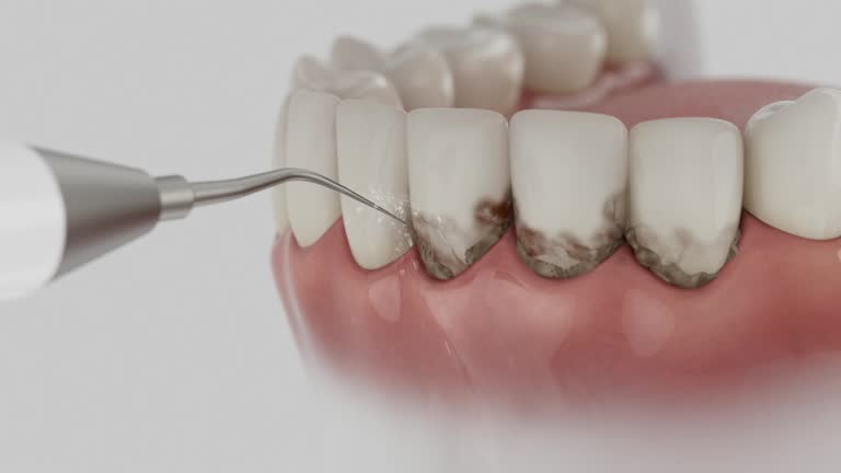 Trusted Tooth Extraction service in Travis Ranch, TX - Dentist Open Now